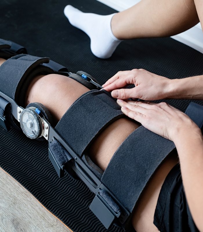 Female buckling knee orthosis or knee support brace after surgery on leg